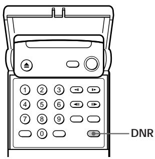 SONY DVP-S3000 - Reducing the Picture Noise (DNR: Digital Video Noise Reduction) - 1