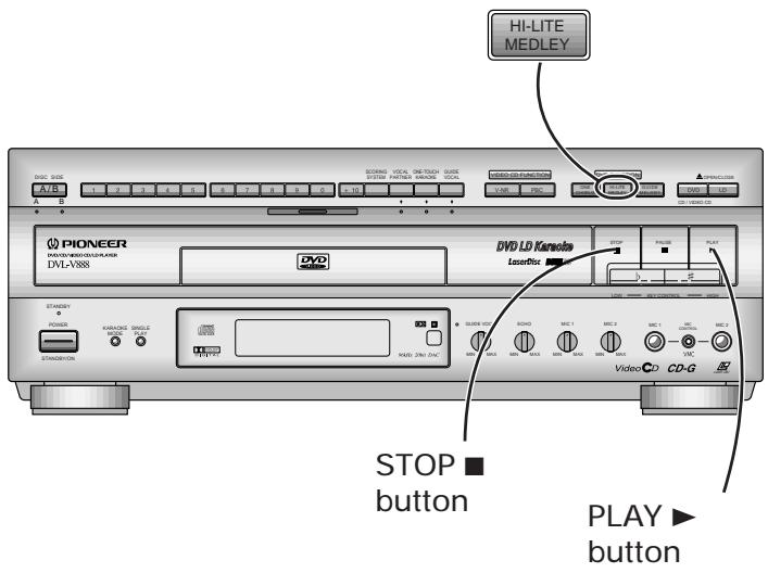 PIONEER DVL-V888 - Consecutive Play of Song Highlights (HI-LITE MEDLEY) - 1
