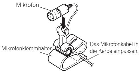 PIONEER FH-P80BT - Befestigung des Mikrofons an der Lenksäule - 1