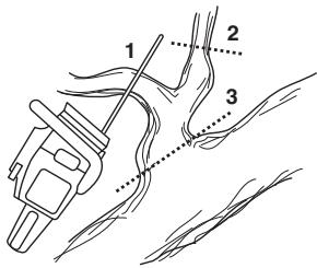 1 2 3