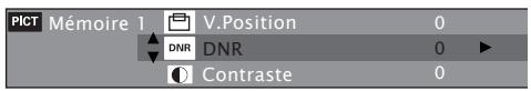 DENON DBP-4010UD - Ajustement de la qualité d'image (Contrôle d'image) - 2