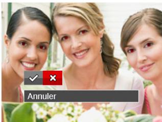 Annuler
