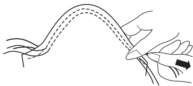 ELNA 560 - Left of teeth - 3