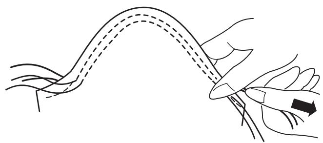 ELNA 680 - Left of teeth - 3