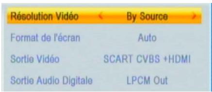 SEDEA SNT850HD USB - 2) Système TV - 1