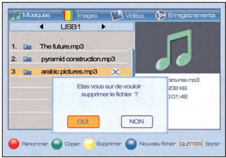 SERVIMAT TSF4500C - LECTEUR MULTIMEDIA (mode musique, éditer, supprimer une musique) - 1