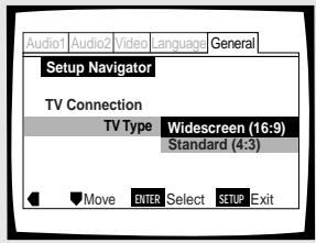 PIONEER DV-575A - Einstellen des Bildseitenverhältnisses - 1