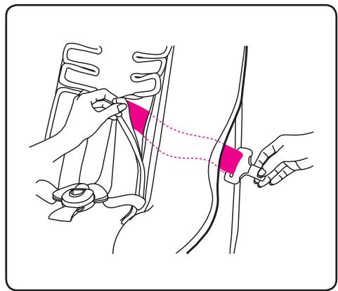 Medical illustration showing a procedure with labeled points and a dotted line indicating a step or connection point.
