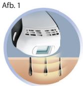 REMINGTON BKT4000 SMOOTH&SILKY - Wat is IPL (Intense Pulse Light) en hoe werkkt i-Light? - 1