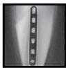 REMINGTON HC5700  -  HC5900 - Indicators - 2