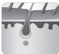 BABYLISS IPL HOMELIGHT SENSOR G960E - Haargroeicyclus - 5