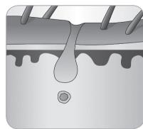 BABYLISS IPL HOMELIGHT SENSOR G960E - Ciclo di crescita del pelo - 8