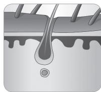 BABYLISS IPL HOMELIGHT SENSOR G960E - Hair growth cycle - 7
