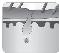 BABYLISS IPL HOMELIGHT SENSOR G960E - Anmerkung: - 2