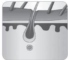 BABYLISS HOMELIGHT G971PE - How does the light eliminate hair? - 5