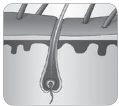 BABYLISS HOMELIGHT G971PE - How does the light eliminate hair? - 4