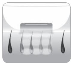 BABYLISS HOMELIGHT G971PE - In che modo la luce riesce a eliminare il pelo? - 3