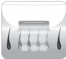 BABYLISS HOMELIGHT G971PE - Comment la lumière parvient-elle à éliminer le poil? - 2