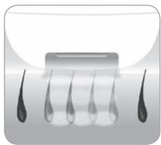 BABYLISS HOMELIGHT G971PE - Como é que a luz elimina os pêlos? - 2