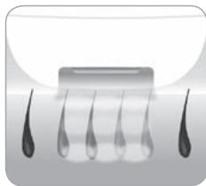 BABYLISS HOMELIGHT G971PE - ¿Cómo logra la luz eliminar el vello? - 2