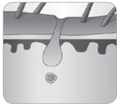 BABYLISS HOMELIGHT G971PE - ¿Cómo logra la luz eliminar el vello? - 6
