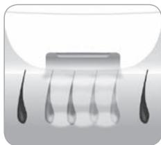 BABYLISS HOMELIGHT G971PE - ■ Wie können Haare durch Licht beseitigt werden? - 2