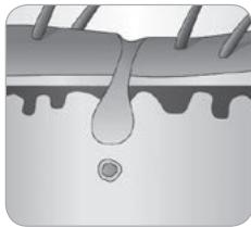 BABYLISS HOMELIGHT G971PE - Como é que a luz elimina os pêlos? - 6