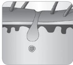 BABYLISS HOMELIGHT G971PE - How does the light eliminate hair? - 6
