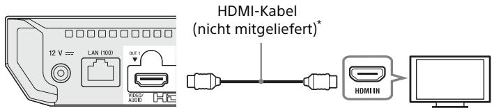 SONY X700 - AnschlieBen an Ihr Fernsehgerät - 1