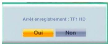 Arrêt enregistrement : TF1 HD Oui Non