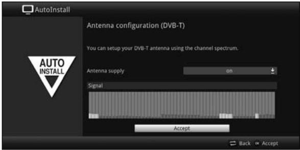 TECHNISAT TECHNICORDER ISIO SC  -  TECHNICORDER ISIO STC - Antenna configuration (DVB-T) - 1