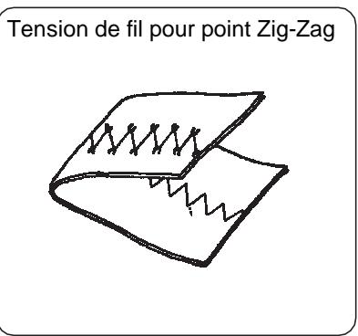 BLAUPUNKT CASUAL 845 - Réglage de la tension du fil - 4