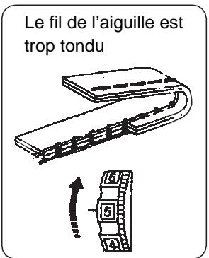 BLAUPUNKT CASUAL 845 - Réglage de la tension du fil - 2