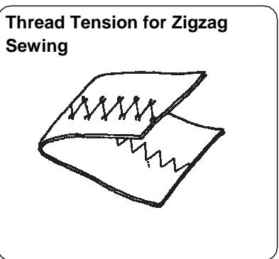 BLAUPUNKT CASUAL 845 - Balancing Needle Thread Tension - 4
