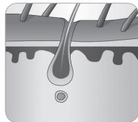 BABYLISS G935E - Rüstov cyklus chloupku - 5