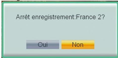 CGV ETIMO 2TC - Arrêter un enregistrement - 2