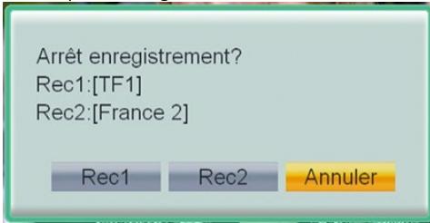 CGV ETIMO 2TC - Arrêter un enregistrement - 1