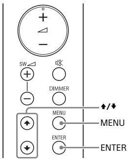 SONY HTSF150 - Connecting the Subwoofer Manually - 2