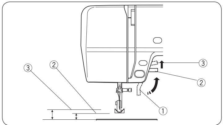 AEG-ELECTROLUX 70X - - Retrait de la pédale - 1