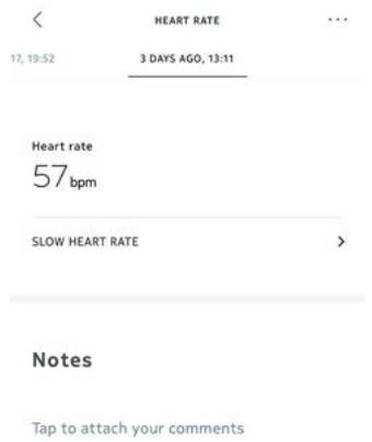NOKIA BODY CARDIO - Récapération des mesures du rythme cardiaque - 1