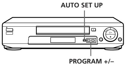 SONY SLV-E730NP - Einstellen des Videorecorders mit der automatischen Einstellfunktion - 1