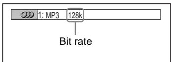 SONY DVP-LS785V - Example: - 1
