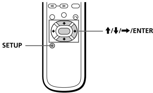 SONY PBD-V30 - Basic settings (INITIAL SETUP) - 1