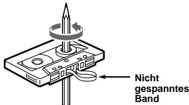 SONY XR-L500V - Pflege der Kassetten - 1