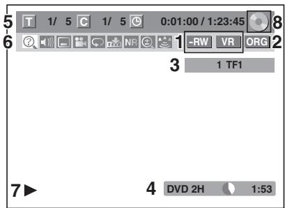 THOMSON CB 1000 - DVD - 1