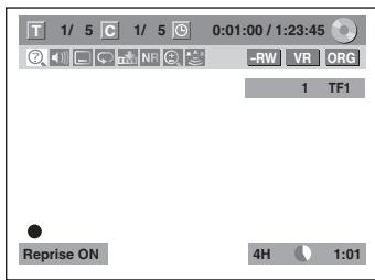 THOMSON CB 1000 - Appuyez une fois sur [STOP ■] pour arrêter la lecture. - 1