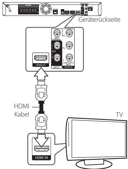 PIONEER BCS-414 - HDMI-Anschluss - 1