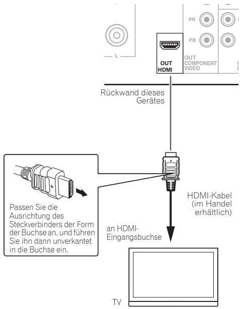 PIONEER X-HM31V-K - Hinweis - 1