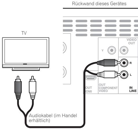 PIONEER X-HM31V-K - Hinweis - 1