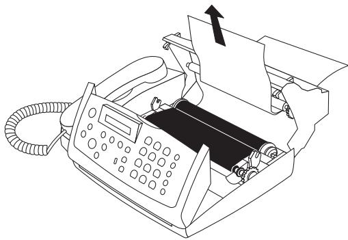 SAGEM PHILIPS MAGIC - Bourrage de papier - 1